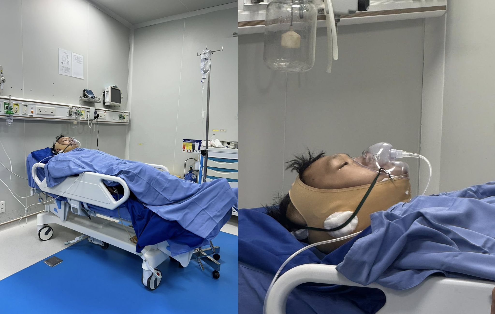 Trọng Nhân sau khi phẫu thuật xong
